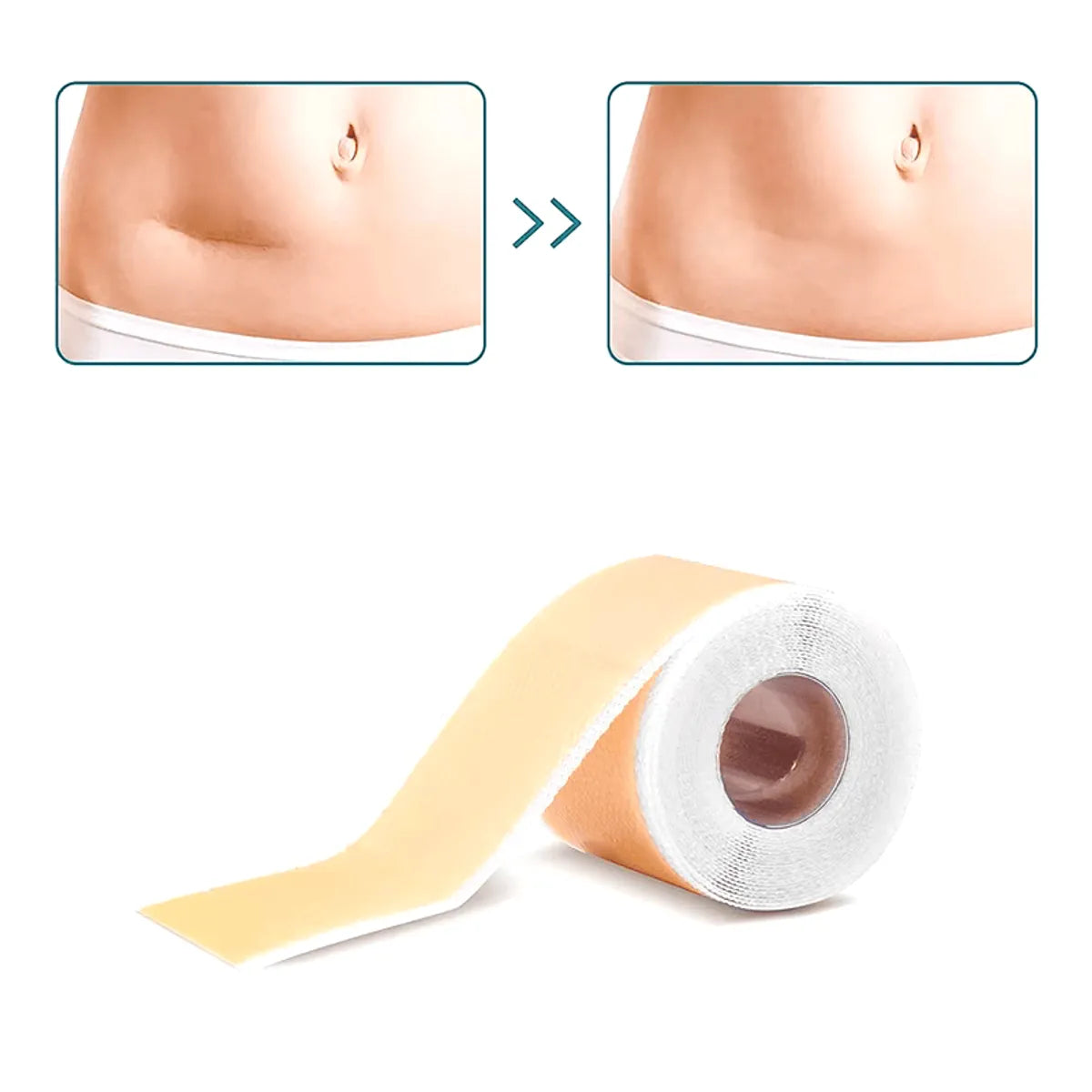 Parche de Silicona para Cicatrices y Queloides Rollo 4 cm x 1,5 Metros